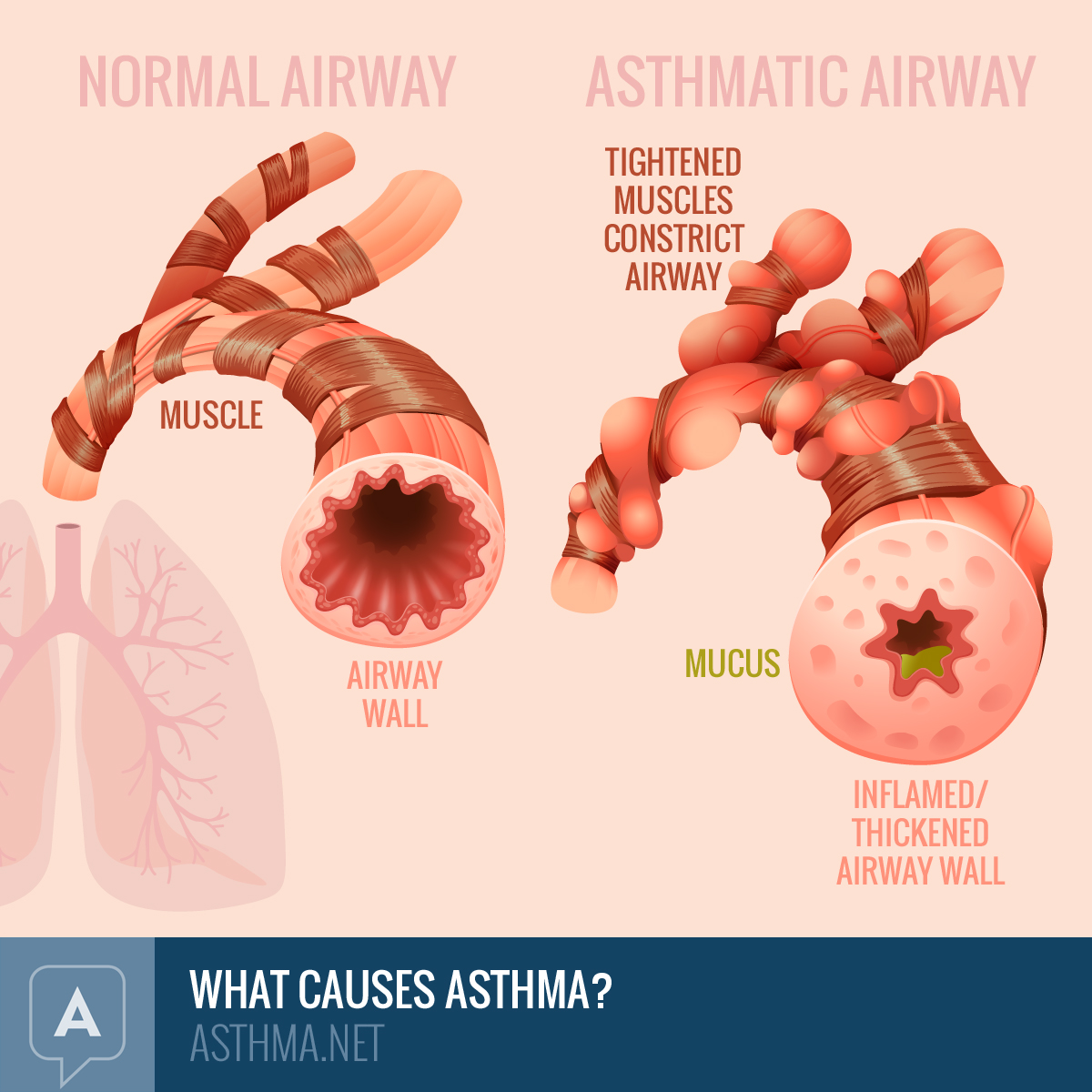 what does asthma do to your lungs