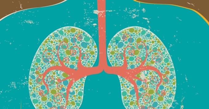 Severe Asthma: What Is Airway Remodeling? image