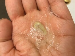 thick yellow mucus in the contributor's hand