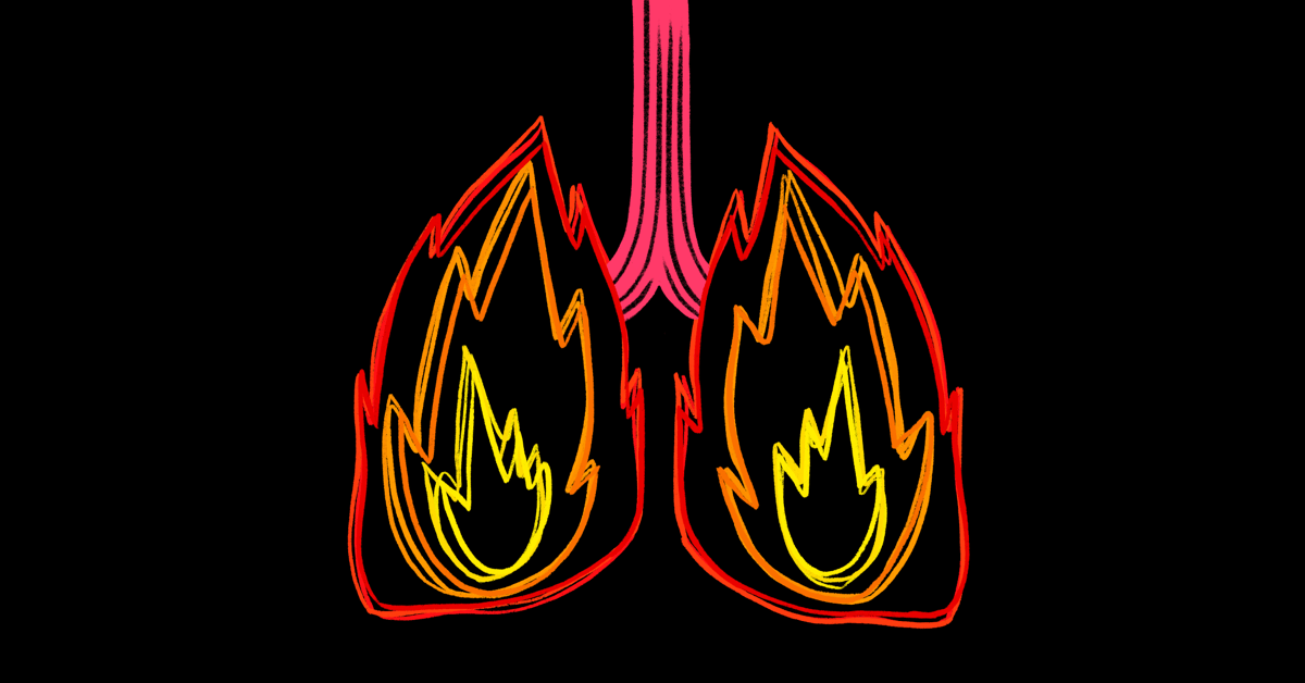 Have You Had an Asthma Attack During a Stressful Situation?